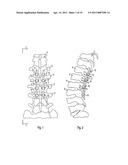 DEVICE FOR DYNAMIC STABILIZATION OF BONES OR BONE FRAGMENTS diagram and image