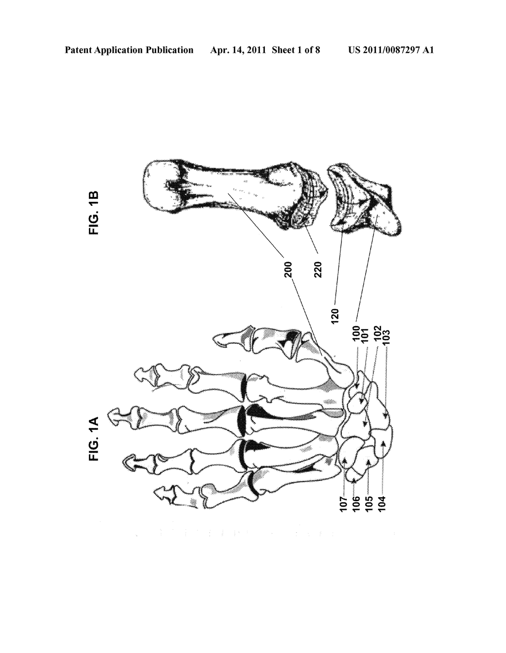 INTERNAL JOINT STABILIZER FOR A MULTI-AXIS JOINT, SUCH AS A CARPO-METACARPAL JOINT OR THE LIKE, AND METHOD OF USE - diagram, schematic, and image 02