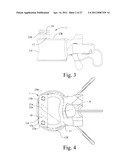 LUMBAR IMPLANT diagram and image