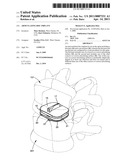 ARTICULATING DISC IMPLANT diagram and image