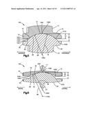 ARTICULATING DISC IMPLANT diagram and image