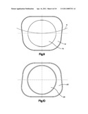 ARTICULATING DISC IMPLANT diagram and image