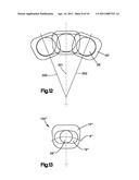 ARTICULATING DISC IMPLANT diagram and image