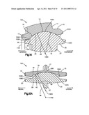 ARTICULATING DISC IMPLANT diagram and image