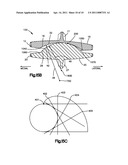 ARTICULATING DISC IMPLANT diagram and image