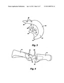 ARTIFICIAL TOE JOINT diagram and image