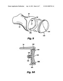 ARTIFICIAL TOE JOINT diagram and image