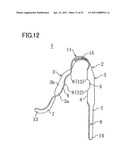 CONTAINER LID OPENING DEVICE diagram and image