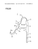 CONTAINER LID OPENING DEVICE diagram and image