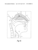 NASAL DELIVERY DEVICES diagram and image