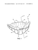 CUSTOM MOUTHGUARD diagram and image