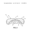 CUSTOM MOUTHGUARD diagram and image