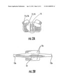 METHODS FOR FORMING IMPLANTS WITH SELECTIVELY EXPOSED MESH FOR FIXATION AND RELATED IMPLANTS diagram and image