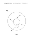 Opthalmic Lens With Regressive and Non-Regressive Rotationally Symmetric Optical Design Elements diagram and image