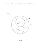 Opthalmic Lens With Regressive and Non-Regressive Rotationally Symmetric Optical Design Elements diagram and image