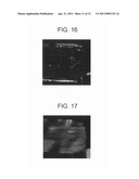 IMAGE PROCESSING APPARATUS AND METHOD, AND PROGRAM diagram and image