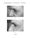 OLEANOYL PEPTIDE COMPOSITION AND A METHOD OF TREATING SKIN AGING diagram and image