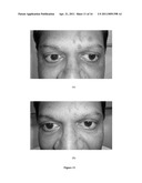 OLEANOYL PEPTIDE COMPOSITION AND A METHOD OF TREATING SKIN AGING diagram and image