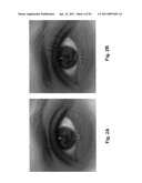 COMPOSITION AND METHODS FOR PROMOTING LUSH HAIR GROWTH diagram and image