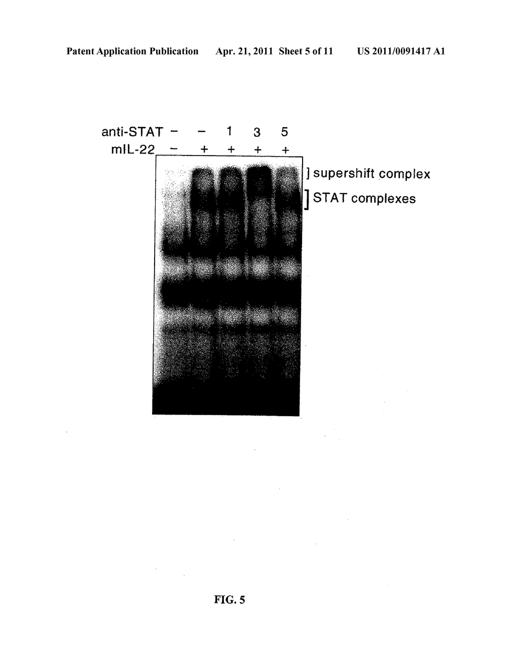 Interleukin-22 Polypeptides, Nucleic Acids Encoding The Same And Methods For The Treatment Of Pancreatic Disorders - diagram, schematic, and image 06