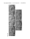 Methods for Promoting the Revascularization and Reenervation of CNS Lesions diagram and image