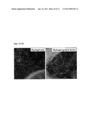 Methods for Promoting the Revascularization and Reenervation of CNS Lesions diagram and image