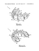 Orthodontic appliance diagram and image