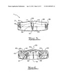 Orthodontic appliance diagram and image