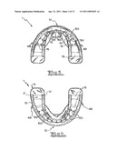 Orthodontic appliance diagram and image