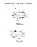 Orthodontic appliance diagram and image