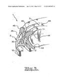 Orthodontic appliance diagram and image