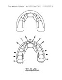 Orthodontic appliance diagram and image