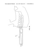 Dental Measurement Apparatus and System diagram and image