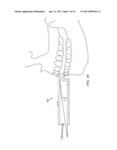 Dental Measurement Apparatus and System diagram and image