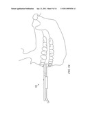 Dental Measurement Apparatus and System diagram and image