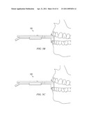 Dental Measurement Apparatus and System diagram and image