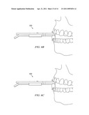 Dental Measurement Apparatus and System diagram and image