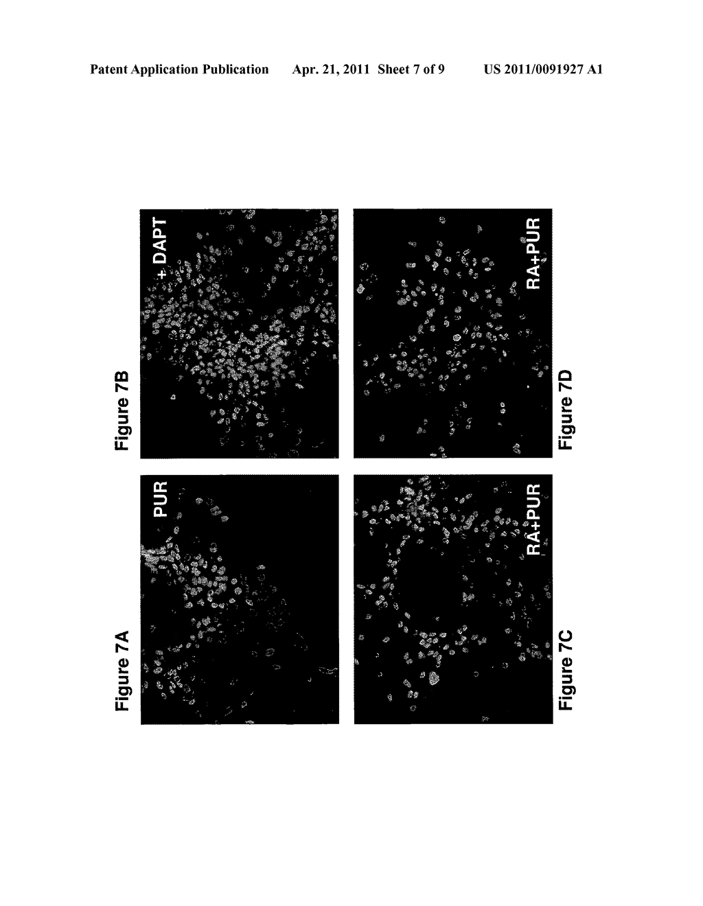 MOTOR NEURONS DEVELOPED FROM STEM CELLS - diagram, schematic, and image 08