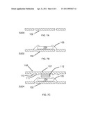 INTEGRATED CIRCUIT PACKAGE HAVING A CASTELLATED HEATSPREADER diagram and image