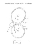 EUTHANASIA OF POULTRY diagram and image