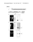 TREATMENT OF PARKINSON S DISEASE diagram and image