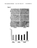 TREATMENT OF PARKINSON S DISEASE diagram and image