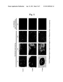 Anticancer agent containing bl-angiostatin diagram and image