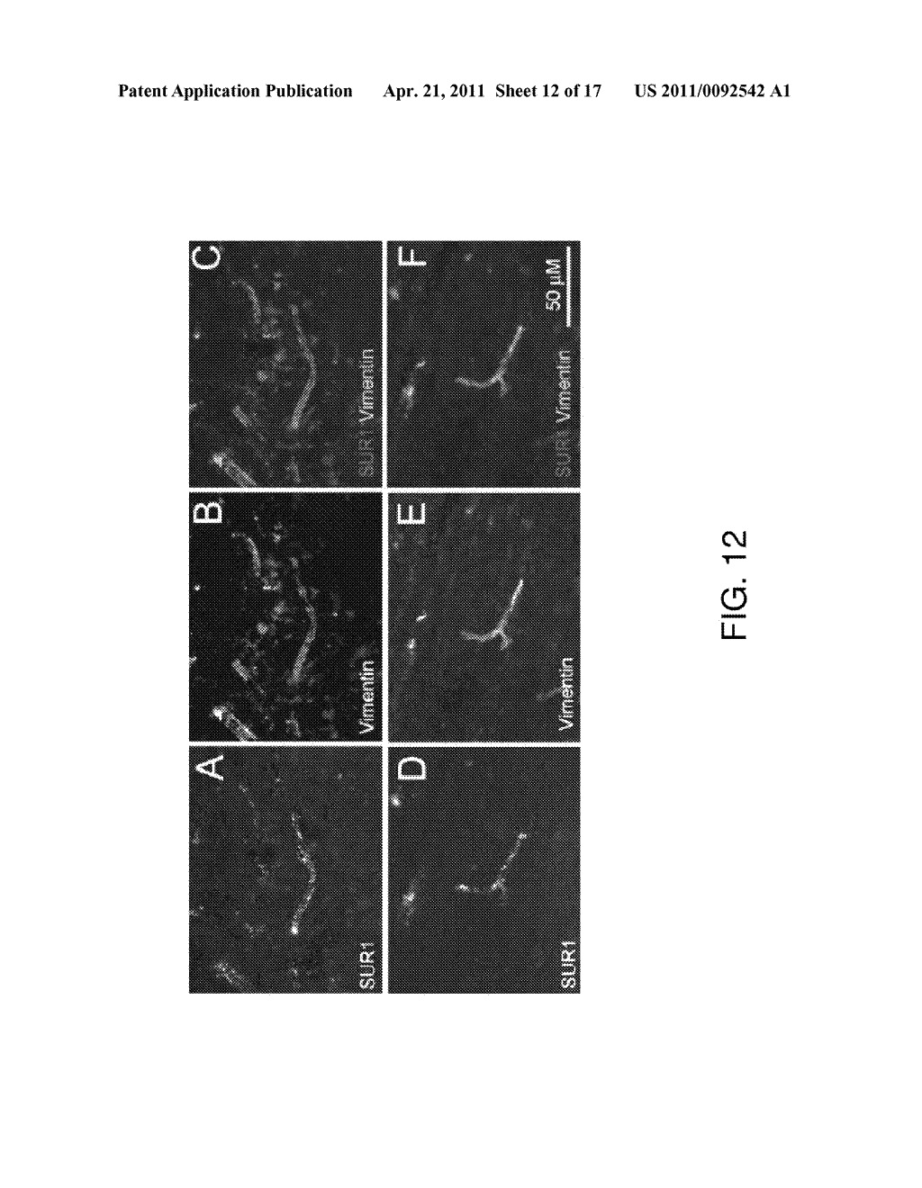 METHODS FOR TREATING SPINAL CORD INJURY WITH A COMPOUND THAT INHIBITS A NCCA-ATP CHANNEL - diagram, schematic, and image 13