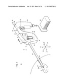 MEDICAL MANIPULATOR diagram and image