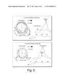 CARDIAC COORDINATE SYSTEM FOR MOTION ANALYSIS diagram and image