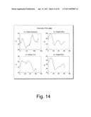 CARDIAC COORDINATE SYSTEM FOR MOTION ANALYSIS diagram and image