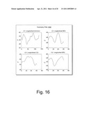 CARDIAC COORDINATE SYSTEM FOR MOTION ANALYSIS diagram and image