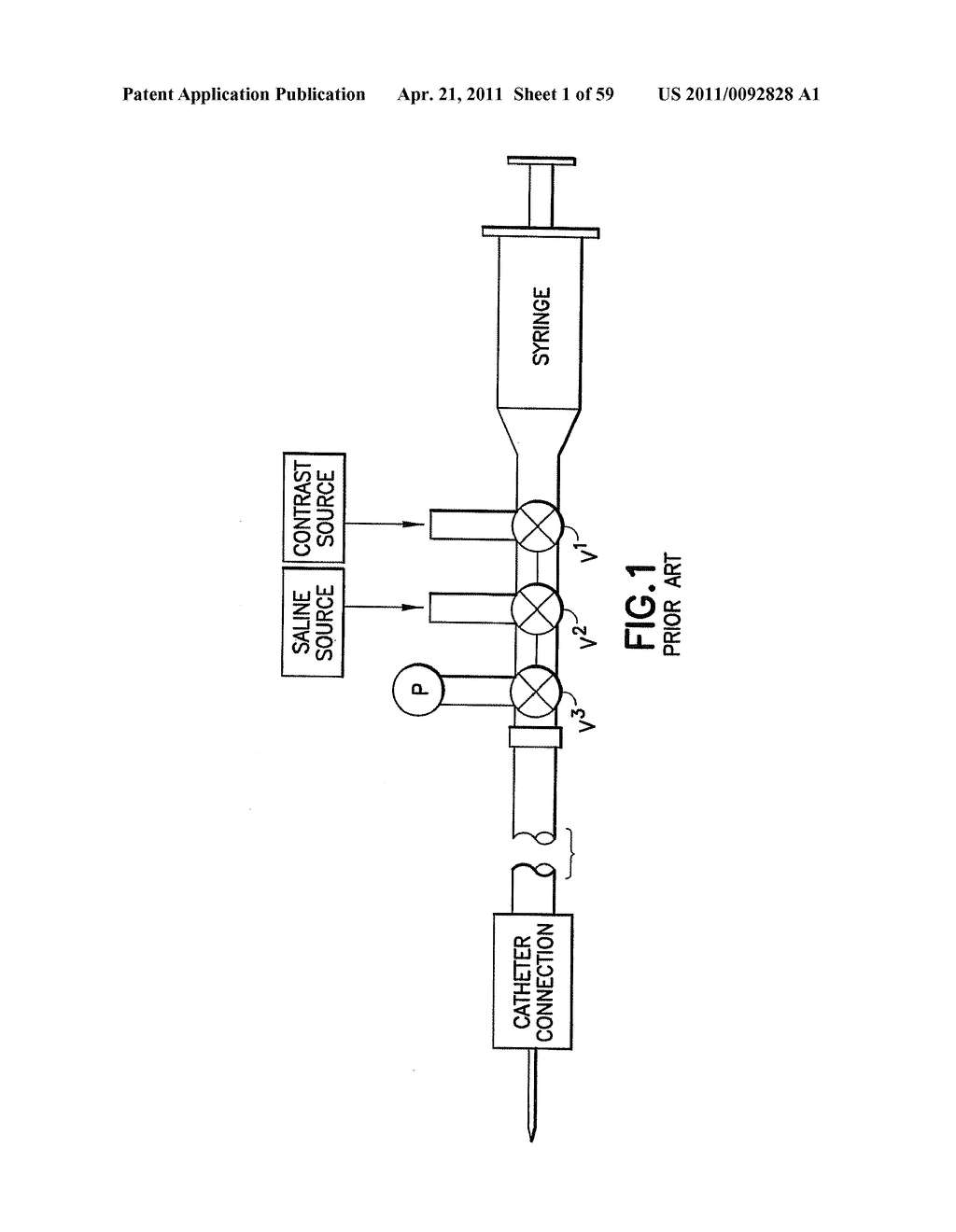 Fluid Delivery System, Fluid Path Set, and Pressure Isolation Mechanism with Hemodynamic Pressure Dampening Correction - diagram, schematic, and image 02