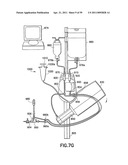 Fluid Delivery System, Fluid Path Set, and Pressure Isolation Mechanism with Hemodynamic Pressure Dampening Correction diagram and image